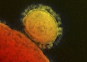 Handout transmission electron micrograph shows the Middle East respiratory syndrome (MERS) coronavirus