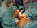 632px-Caesarian_section_-_Pull_out