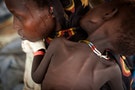 內戰無止期 南蘇丹25萬兒童面臨飢餓威脅