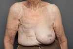 inkr-赤祼真實-100個女人的乳房-解放媒體美化後真實的酥胸-017-570x380