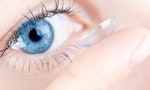 眼科醫師解答：「近視控制日拋隱形眼鏡」跟「角膜塑型片」差別在哪裡？