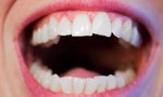 Teeth-Mouth-Hygiene-Dental-White-Dentist