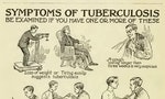 The Fall and Rise of Tuberculosis: A First World Problem 