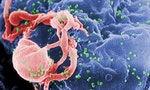 人類至今無法治癒愛滋病，但科學家已離解方愈來愈近