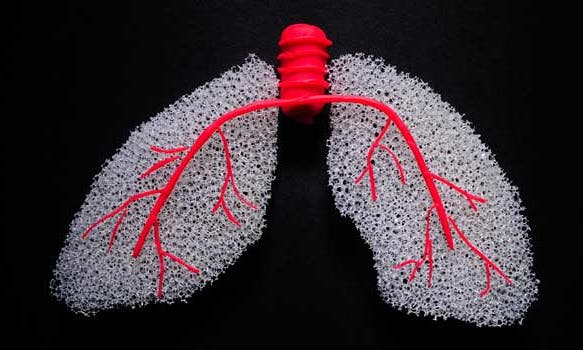 關於肺癌，你最想知道的５件事