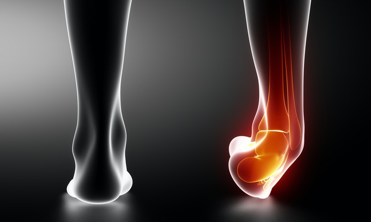 常扭到腳可能是「慢性腳關節不穩定」，利用超簡單訓練課表增進復原力