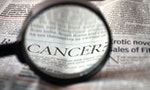 癌症36年蟬聯10大死因首位：哪一種最「折壽」？