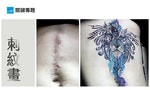 【公益刺青】修補身心靈傷疤，幫助患癌者與受暴者重拾自信的「刺青美容術」