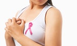 BRCA1基因變異者乳癌機率達八成，可考慮「預防性全乳房切除手術」