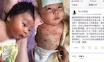 中國過期疫苗江蘇金湖