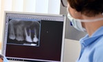 拍牙齒X光片卻擔心輻射？18張劑量等同「一趟長途飛機」
