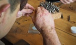 以色列研發出透明的「人工皮膚」，用「噴」的解決燒燙傷患者換藥痛苦