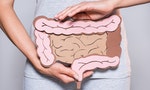 腸子 partial view of woman holding paper made large intestine on grey background - 圖片