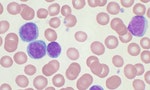 Chronic_lymphocytic_leukemia
