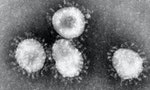 揪出「武漢肺炎」元兇：第七種會感染人類的「冠狀病毒」，一生只有三個目標