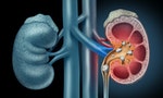 腎結石的治療時機與方式：四種震碎和打爆效果的優缺點比較