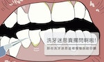 為什麼洗完牙齒還是黃黃的？認真刷牙、用牙線就不用洗牙嗎？
