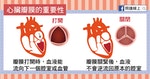 心臟瓣膜疾病-03