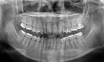 「牙齒矯正」流程介紹：為什麼不是第一次去就裝上矯正器？