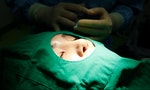 防疫戴口罩助攻，韓國醫美整容業規模去年成長9.2%