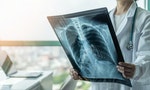 肺癌專家圖文解析：「癌症骨轉移」讓患者痠痛不適，卻常被誤以為退化或工作勞累