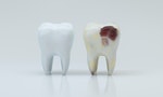 牙醫師圖解說明：牙齒掉落、斷裂怎麼辦？有可能把牙齒「種」回去嗎？