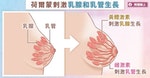 breast-change_(2)