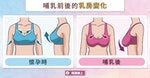 breast-change_(3)