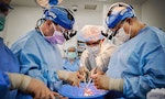 異種移植邁大步，紐約大學醫師成功移植基改豬心到腦死病人身上，無排斥跡象