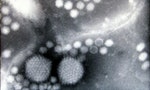 最新研究：多國爆發不明原因的嚴重兒童急性肝炎，可能是AAV2和輔助病毒共同感染