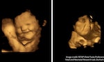 研究：胎兒表情透露對味道喜好，紅蘿蔔呈「笑臉」、羽衣甘藍偏向「哭臉」